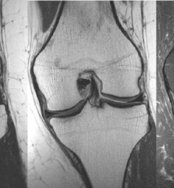 Rheumatology, Osteology & MSK