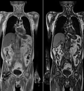 Systemic Inflammatory and Infectious Disease