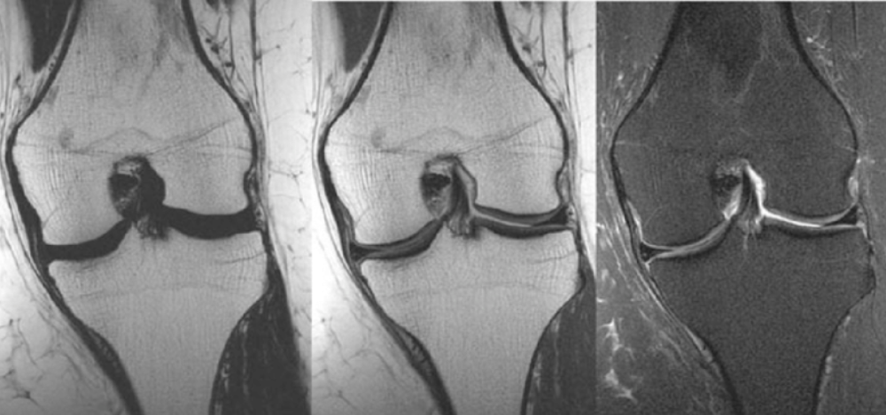 Rheumatology, Osteology & MSK